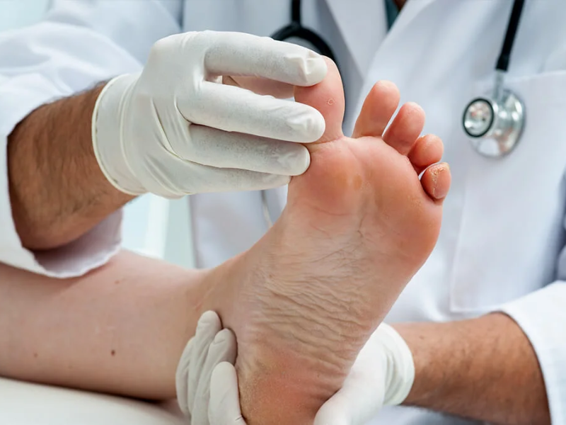 Diabetes and Foot Care